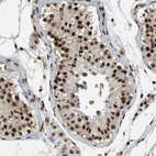 Immunohistochemical staining of human testis shows moderate to strong nuclear positivity in cells in seminiferous ducts.