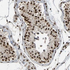 Immunohistochemical staining of human testis shows moderate to strong nuclear positivity in cells in seminiferous ducts.