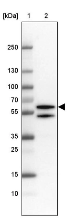Lane 1: Marker [kDa] 250, 130, 100, 70, 55, 35, 25, 15, 10_br/_Lane 2: Human cell line RT-4
