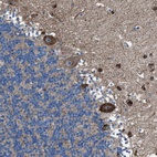 Anti-TMEM126B Antibody