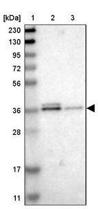 Lane 1: Marker [kDa] 230, 130, 95, 72, 56, 36, 28, 17, 11_br/_Lane 2: Human cell line RT-4_br/_Lane 3: Human cell line U-251MG sp