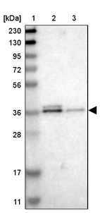 Lane 1: Marker [kDa] 230, 130, 95, 72, 56, 36, 28, 17, 11_br/_Lane 2: Human cell line RT-4_br/_Lane 3: Human cell line U-251MG sp