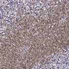 Immunohistochemical staining of human cerebellum shows strong positivity in neuronal processes in cells in granular layer.