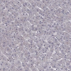 Immunohistochemical staining of human liver shows no positivity in hepatocytes as expected.