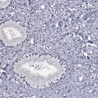 Immunohistochemical staining of human cervix, uterine shows no positivity in glandular cells as expected.