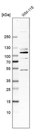 Western blot analysis in human cell line WM-115.