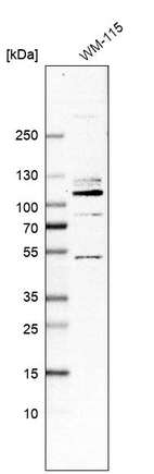 Western blot analysis in human cell line WM-115.