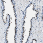 Anti-BRICD5 Antibody