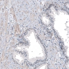 Immunohistochemical staining of human prostate shows weak positivity in nuclear membrane in glandular cells, as well as in smooth muscle cells.