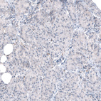Anti-TMEM43 Antibody