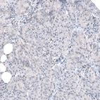 Immunohistochemical staining of human pancreas shows no positivity in exocrine glandular cells as expected.