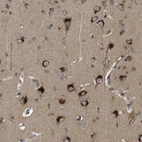 Immunohistochemical staining of human cerebral cortex shows positivity in neurons.