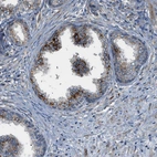 Immunohistochemical staining of human prostate shows positivity in glandular cells.