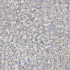 Immunohistochemical staining of human liver shows very weak positivity in hepatocytes.