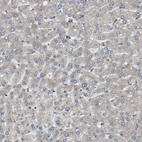 Immunohistochemical staining of human liver shows very weak positivity in hepatocytes.