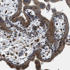 Immunohistochemical staining of human placenta shows positivity in trophoblastic cells.