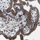 Immunohistochemical staining of human placenta shows positivity in trophoblastic cells.