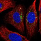 Immunofluorescent staining of human cell line U-2 OS shows localization to vesicles.