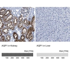 Anti-AQP1 Antibody
