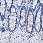Immunohistochemical staining of human rectum shows moderate positivity in apical membranes in glandular cells.