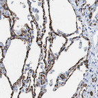 Immunohistochemical staining of human lung shows strong membranous positivity in endothelial cells.