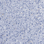 Immunohistochemical staining of human liver shows no positivity in hepatocytes as expected.