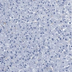 Immunohistochemical staining of human liver shows no positivity in hepatocytes as expected.