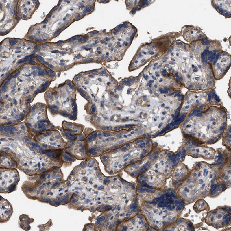Anti-BTN2A1 Antibody
