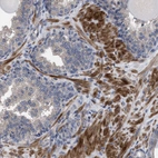 Immunohistochemical staining of human prostate shows strong cytoplasmic positivity in smooth muscle cells.