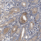 Immunohistochemical staining of human stomach shows weak to moderate membranous positivity in glandular cells.