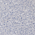 Immunohistochemical staining of human liver shows low positivity in hepatocytes as expected.