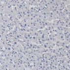 Immunohistochemical staining of human liver shows low positivity in hepatocytes as expected.