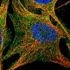 Immunofluorescent staining of human cell line U-2 OS shows localization to plasma membrane.
