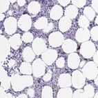 Anti-ZDHHC7 Antibody