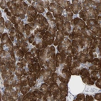 Anti-UBE4B Antibody