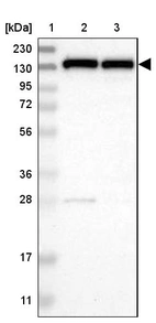 Lane 1: Marker [kDa] 230, 130, 95, 72, 56, 36, 28, 17, 11_br/_Lane 2: Human cell line RT-4_br/_Lane 3: Human cell line U-251MG sp