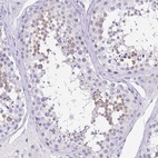 Immunohistochemical staining of human testis shows high expression.