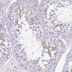 Anti-SPATA4 Antibody