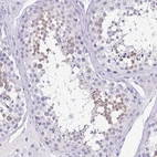 Immunohistochemical staining of human testis shows high expression.