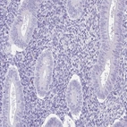 Immunohistochemical staining of human endometrium shows low expression as expected.