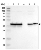 Lane 1: Marker [kDa] 230, 130, 95, 72, 56, 36, 28, 17, 11_br/_Lane 2: Human cell line RT-4_br/_Lane 3: Human cell line U-251MG sp_br/_Lane 4: Human plasma (IgG/HSA depleted)_br/_Lane 5: Human liver tissue_br/_Lane 6: Human tonsil tissue