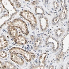 Anti-SMU1 Antibody