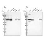 Western blot analysis using Anti-SMU1 antibody HPA019228 (A) shows similar pattern to independent antibody HPA019708 (B).