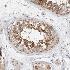 Immunohistochemical staining of human testis shows moderate to strong cytoplasmic positivity in cells in seminiferous ducts.