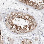 Immunohistochemical staining of human testis shows moderate to strong cytoplasmic positivity in cells in seminiferous ducts.