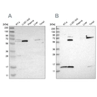 Western blot analysis using Anti-CRAT antibody HPA019230 (A) shows similar pattern to independent antibody HPA020260 (B).
