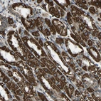 Anti-RBM33 Antibody