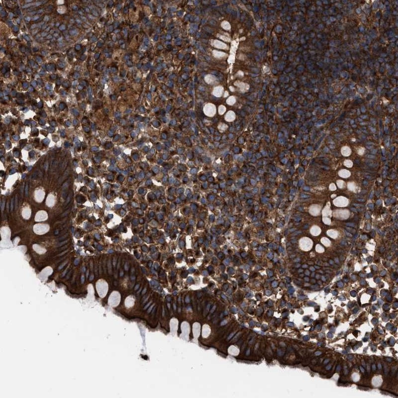Anti-EPS15L1 Antibody