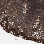 Anti-EPS15L1 Antibody