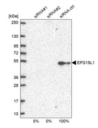 Western blot analysis in U2OS cells transfected with control siRNA, target specific siRNA probe #1 and #2, using Anti-EPS15L1 antibody. Remaining relative intensity is presented.